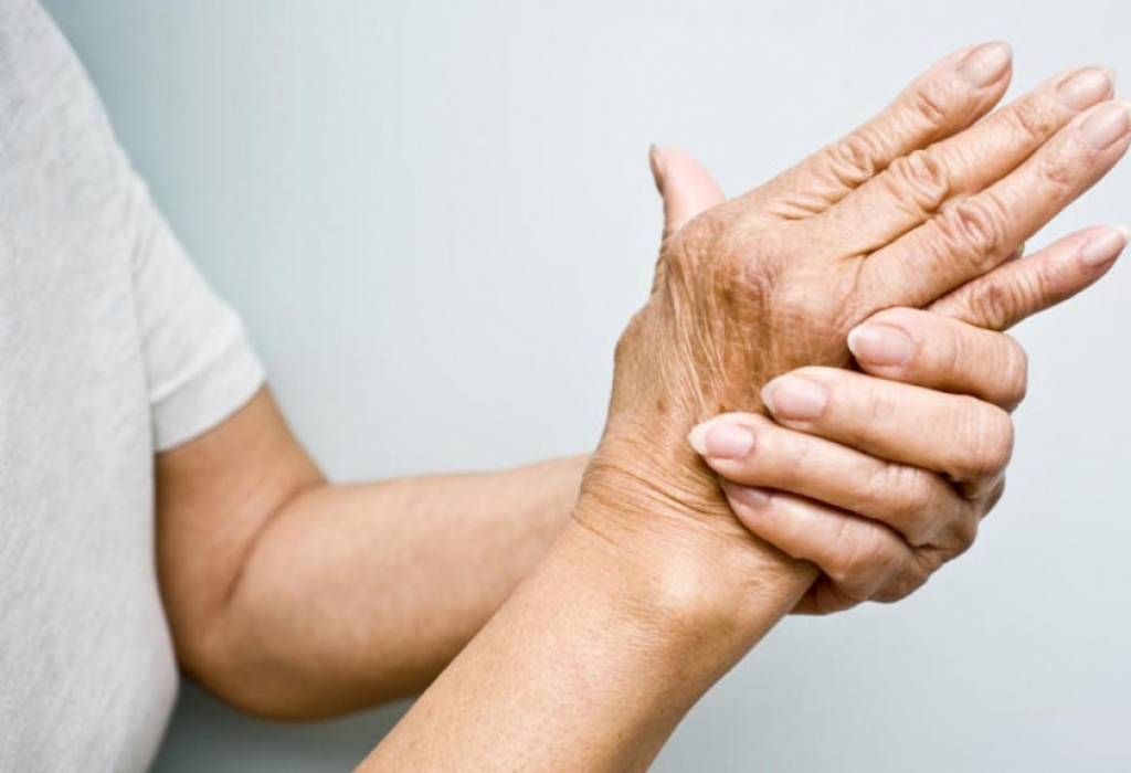 Artritis reumatoide: La enemiga de las articulaciones